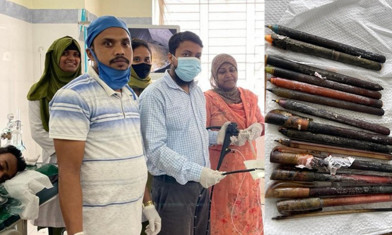 রোগীর পেট থেকে বের করা হলো ১৫ কলম