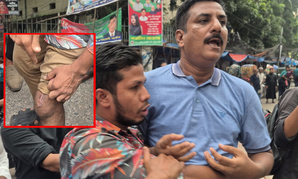 ‘উনিই আমার পায়ে ৪ আগস্ট গুলি করেছে, উনাকে আমি ছাড়ব না’